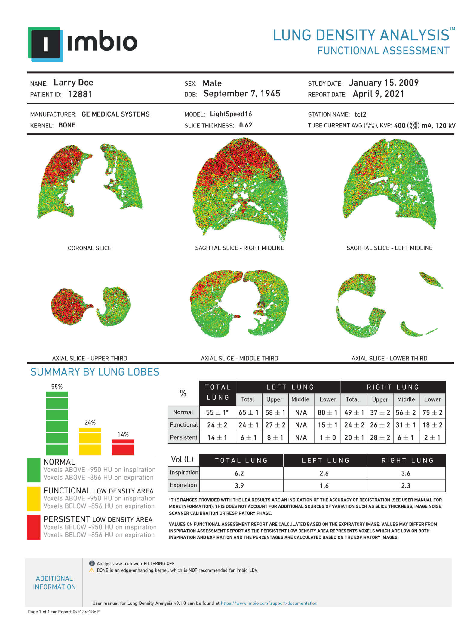 Lung Density Analysis™ Functional Imbio