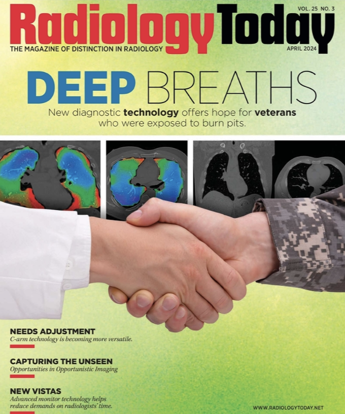 Radiology Today: Deep Breaths—New Technology Offers Hope for Veterans Who Were Exposed to Burn Pits